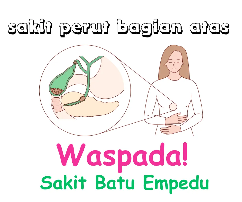 Waspada sakit perut bagian atas bisa jadi penyakit batu empedu